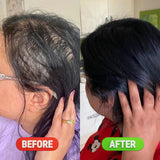 Rosemary & Rice Water Hair Growth Spray - 250ml